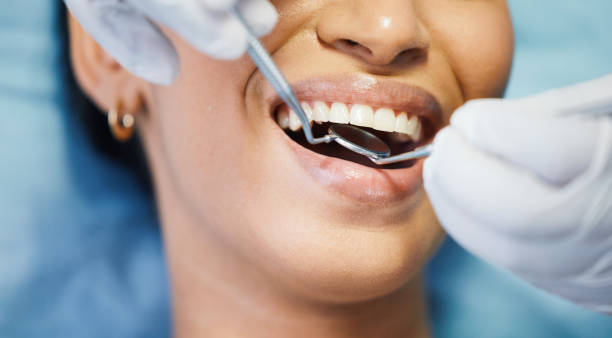 Best Emergency Wisdom Tooth Extraction in Lake Of The Woods, IL